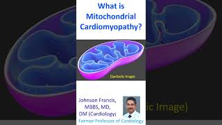 What is Mitochondrial Cardiomyopathy? What is Mitochondrial Cardiomyopathy?