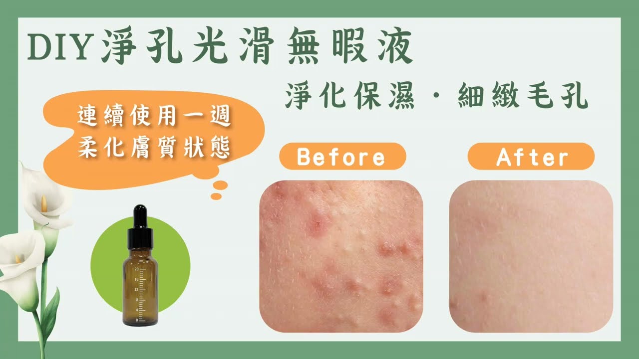 40秒製作【淨孔光滑無暇液】 縮圖