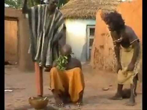 Terapia e çmendur për ta shëruar dhimbjen e kokës (Video)