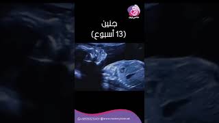 حركة جنين في الأسبوع 13