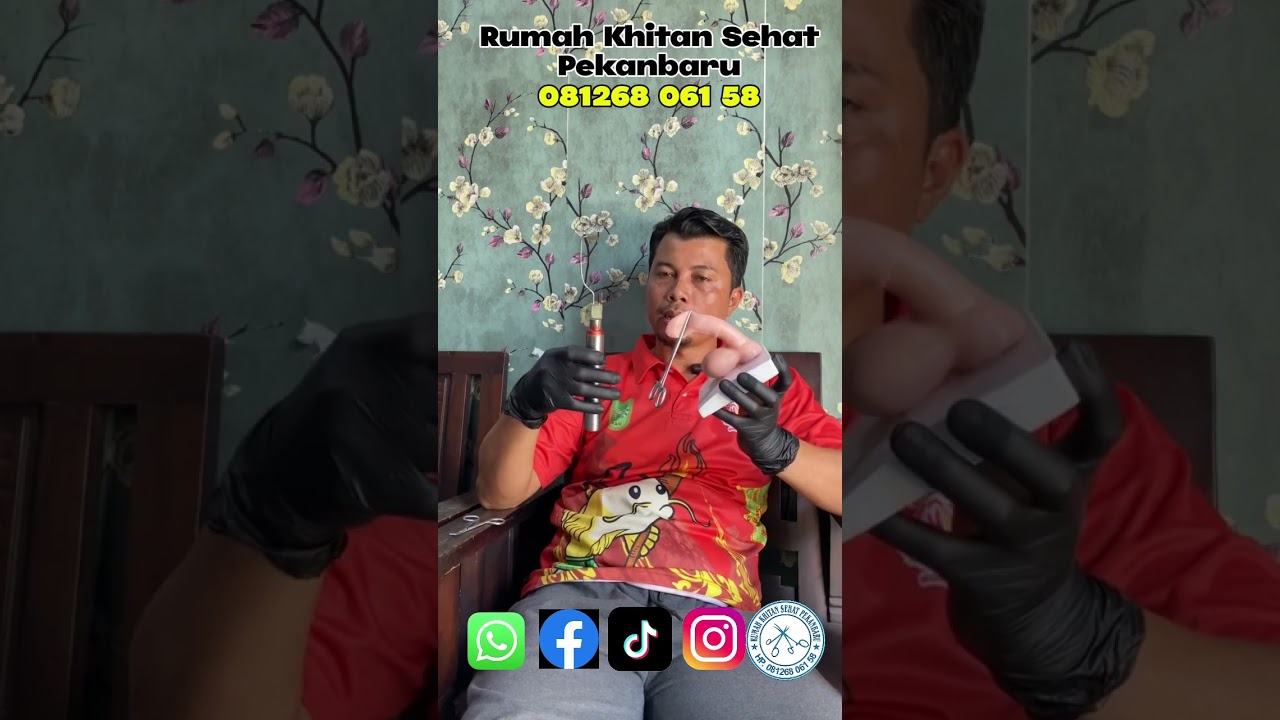 Perbedaan metode khitan biasa, laser dan khitan Klamp 