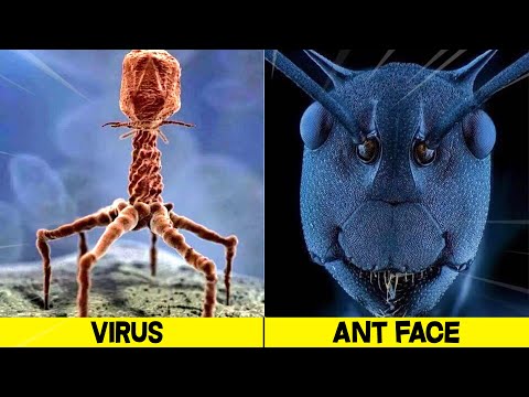 10 Fascinating Objects Under A Microscope - Can You Guess Them?