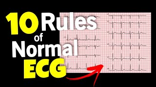 ECG || 10 rules of Normal ECG || ECG interpretation • Daily Cardiology