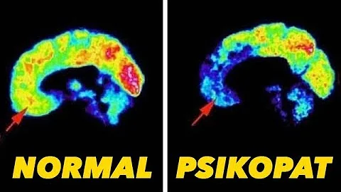 Apakah psikopat ada yang baik?
