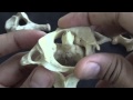 Second cervical vertebra - The Axis
