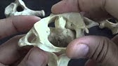 Cervical vertebrae: Atlas & Axis - YouTube