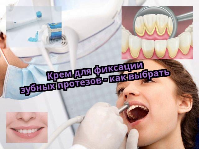 Крем для фиксации зубных протезов - как выбрать