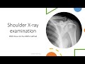 Shoulder X-ray interpretation/examination (ABCS method)