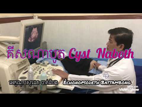 គីសណាបូត Cyst Naboth មាត់ស្បូនស្ត្រី  Dr.SODETNOP អេកូណុបសុដេត