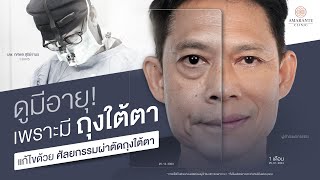 มีถุงใต้ตาแล้วดูแก่ขึ้นจริงไหม? รีวิวผ่าตัดถุงใต้ตาที่ Amarante Clinic