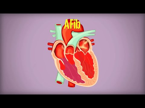 Living with Atrial Fibrillation (AFib)