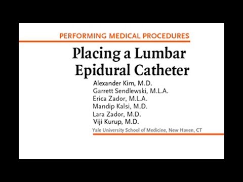 Platzierung epiduraler Lumbalkatheter