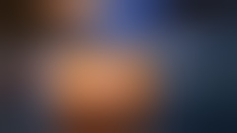 Isthmic Spondy Treated with MIS TLIF Technique and Computer Navigation!!