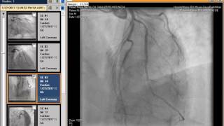 How Can I Play ANGIOGRAM CD In Windows PC screenshot 3