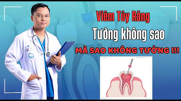 Viêm Tủy Răng Tưởng Không Sao Mà Sao Không Tưởng | Bác sĩ Cường