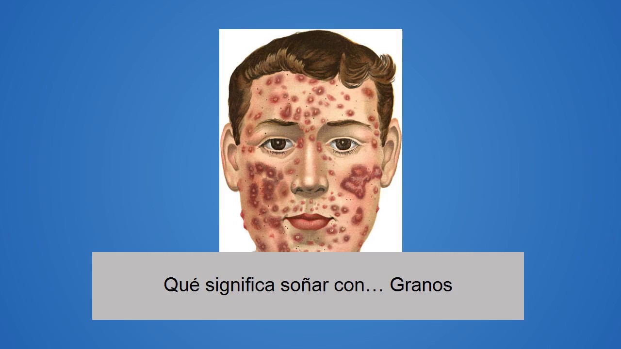 que significa soñar que tienes muchos granos en la cara