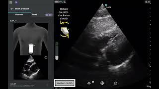 Vscan Air™ Product Tutorial | Caption AI™