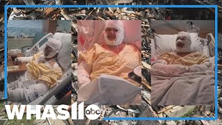 Southern Indiana home explosion survivors struggle with medical costs