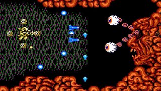 Abadox: The Deadly Inner War (NES) Playthrough