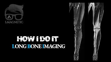 HOW I DO IT - LONG BONE IMAGING