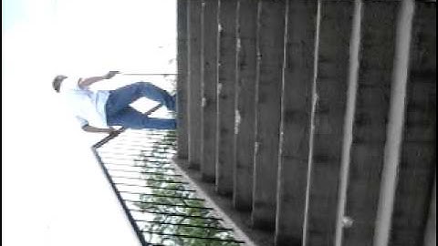 Pre CCSVI Treatment 3 of 5