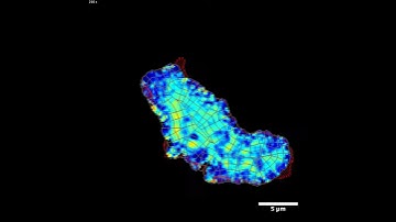 Cell with an integrin sensor filmed using multichannel fluorescence microscopy