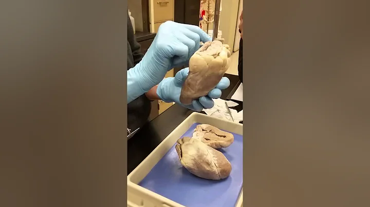 Nancy Gelardi - heart lab #1