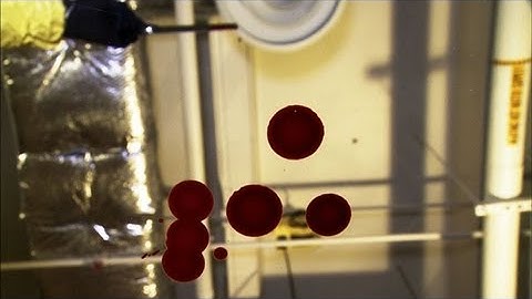 These Are the Three Main Categories of Bloodstain Pattern