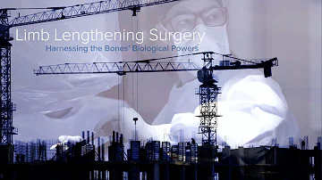 How Limb Lengthening Surgery Works - Yale Medicine Explains