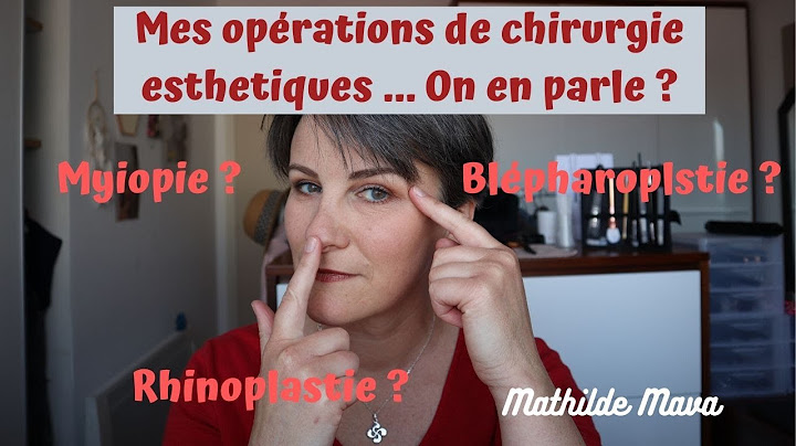 VIDEO142//💁‍CHIRURGIE ESTHETIQUE !!//Je vous dis tout !!👃👁️#chirugieesthétique#rhinoplastie#