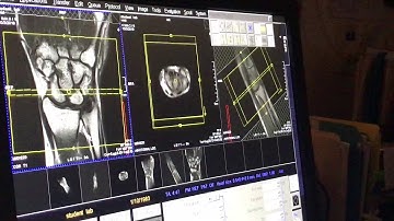 School of Medical Imaging MRI Lab Wrist - Axial Imaging