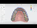 3Shape Splint Studio - The general workflow for Splint Studio