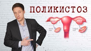 ПСИХОСОМАТИКА. ПОЛИКИСТОЗ