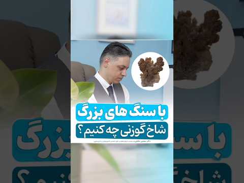 سنگ های بزرگ شاخ گوزنی آیا خسته شدید از درد و نگرانی های بی پایان