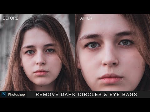 In this photoshop photo retouching tutorial, i will show you how to remove dark circles and bags under eyes photoshop. almost any portrait subject over th...
