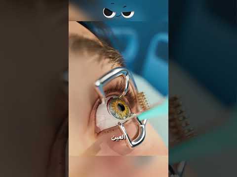 خطأ طبي مرعب دم ر عينيها إلى الأبد