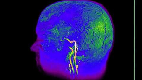 Magnetic Resonance Brain Imaging 2 - William Edward Hahn