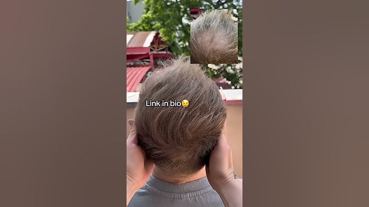 Instantly Fix Thinning Hair! 💇‍♂️ Hair Powder Transformation #balding #confidenceboost #hairloss