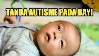 Gejala Autisme Pada Bayi yang Perlu Diwaspadai