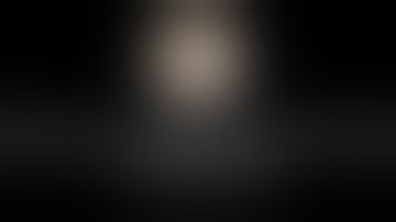 Robotic Pyeloplasty simplified