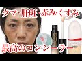 【最高のコンシーラー見つけた】肝斑・シミ・クマ・赤みに悩む46歳の実際のスッピン肌を美しいツヤ肌に見せる最強のベースメイクアイテムをご紹介♡40代50代オススメ！