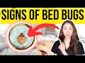 Signs You Have Bed Bugs And How To Get Rid Of Them