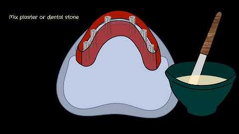 Dental gypsum implants verification jig