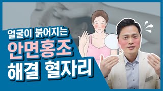 얼굴이 붉어지는 안면홍조 가라앉혀주는 혈자리[갱년기, 호르몬, 자율신경장애, 과로, 화병]