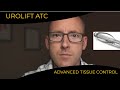 New Urolift ATC (Advanced Tissue Control) for difficult cases