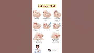 Delivery Step by step | Baby Birth #birth #deliverylife #pregnancy
