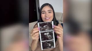 Seré Mamá… *Anthony Está Muy Feliz* ❤️ [ Leito Granda ]