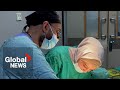 “Human tragedy is huge,” says Toronto doctor performing eye surgery, facial reconstruction in Gaza