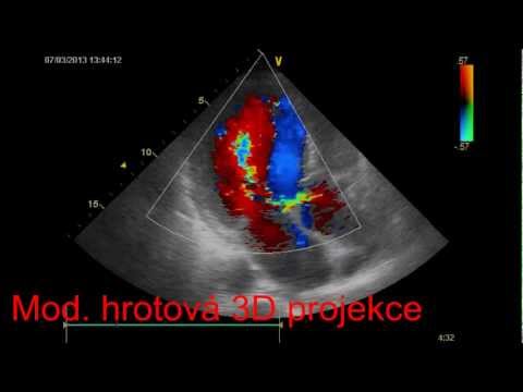 Video: Ultrazvuk Srdca - Indikácie, Metódy