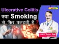 Ulcerative Colitis क्या Smoking से फिर पलटती है ? ||6 WAYS TO PREVENT A ULCERATIVE COLITIS FLARE UP